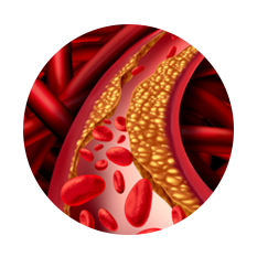 Solution_PeripheralArterial