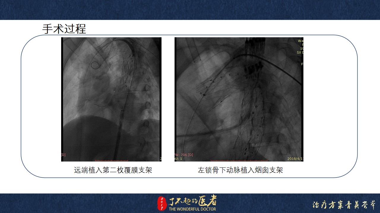 幻燈片11.jpg